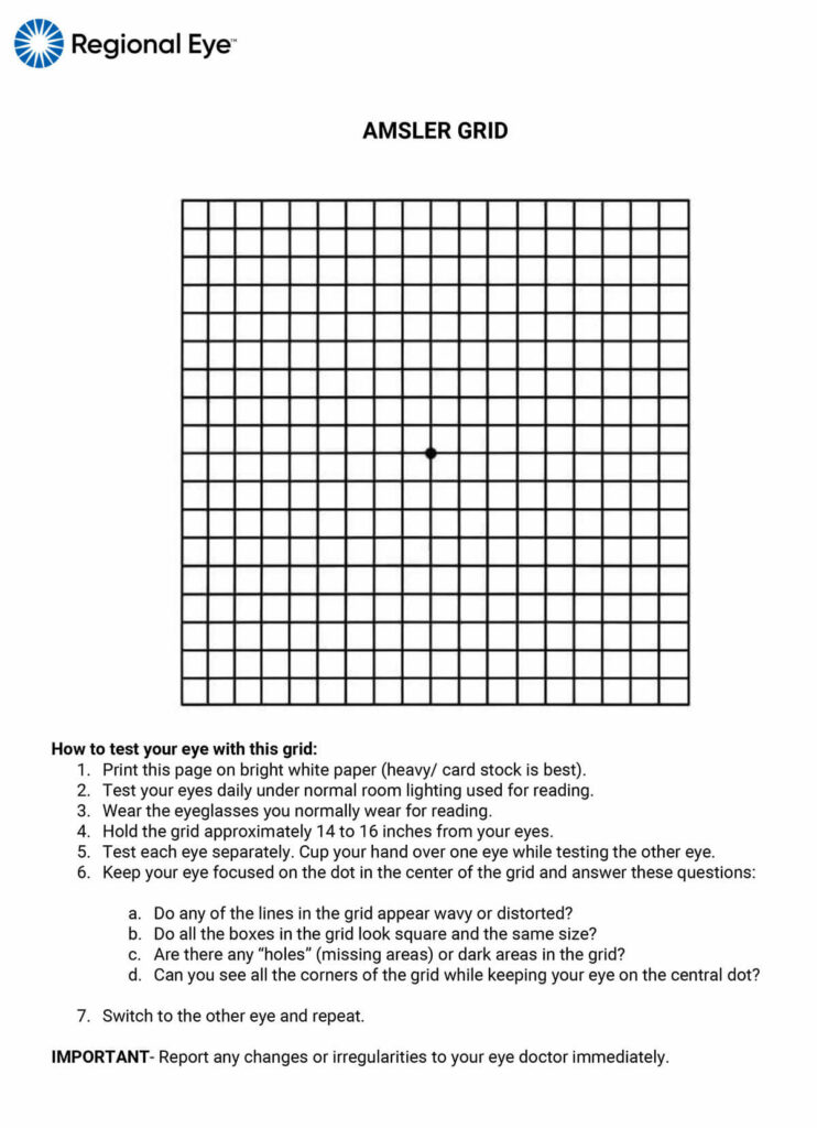 An Amsler grid showing mild distortion.