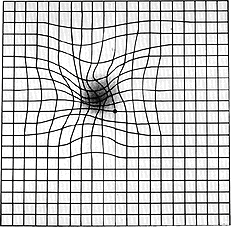 How an Amsler Grid Looks to a Person with ARMD