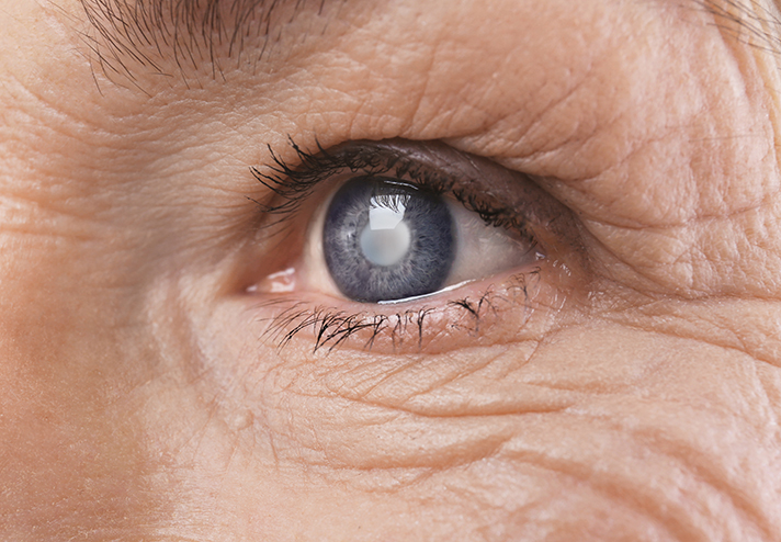 Closeup of a blue eye for the causes of cataracts page.