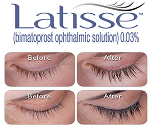 Latisse Logo and Before and After Images